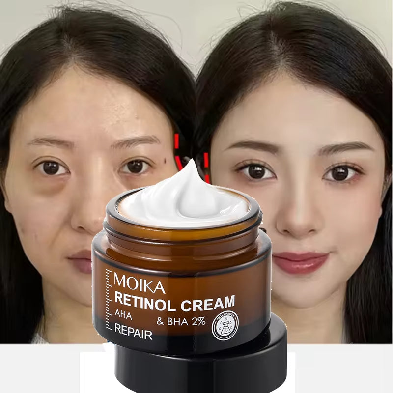 MOIKA Retinol Cream | La crème qui répare et rajeunit visiblement ta peau KAMOTEK