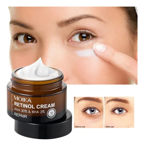 MOIKA Retinol Cream | La crème qui répare et rajeunit visiblement ta peau KAMOTEK